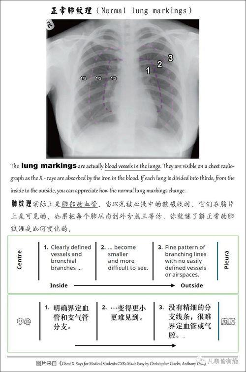 胸片爆料2023年最新版大揭秘